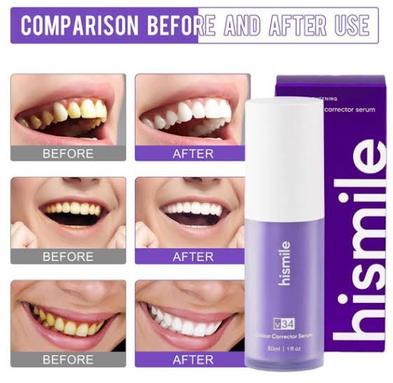 Hismile 30ml V34 Purple Whitening Toothpaste