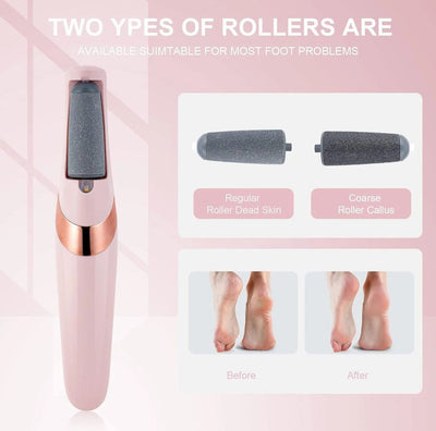 Electric Foot Callus Remover – Dual Roller Pedicure Tool for Dead Skin & Heels - (Foot Cream and Moisturizing Socks Free)